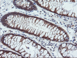 PYCARD / ASC / TMS1 Antibody - IHC of paraffin-embedded Human colon tissue using anti-PYCARD mouse monoclonal antibody. (Heat-induced epitope retrieval by 10mM citric buffer, pH6.0, 100C for 10min).