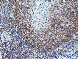 PYCARD / ASC / TMS1 Antibody - IHC of paraffin-embedded Human tonsil using anti-PYCARD mouse monoclonal antibody. (Heat-induced epitope retrieval by 10mM citric buffer, pH6.0, 100C for 10min).