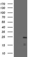 PYCARD / ASC / TMS1 Antibody - HEK293T cells were transfected with the pCMV6-ENTRY control (Left lane) or pCMV6-ENTRY PYCARD (Right lane) cDNA for 48 hrs and lysed. Equivalent amounts of cell lysates (5 ug per lane) were separated by SDS-PAGE and immunoblotted with anti-PYCARD.