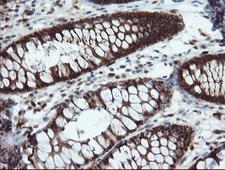 PYCARD / ASC / TMS1 Antibody - IHC of paraffin-embedded Human colon tissue using anti-PYCARD mouse monoclonal antibody.