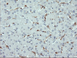 PYCARD / ASC / TMS1 Antibody - IHC of paraffin-embedded Human liver tissue using anti-PYCARD mouse monoclonal antibody.