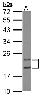 PYCARD / ASC / TMS1 Antibody - Sample (30 ug of whole cell lysate) A: HeLa 12% SDS PAGE PYCARD antibody diluted at 1:1000