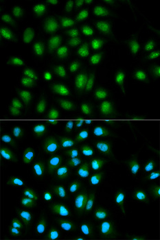 PYCARD / ASC / TMS1 Antibody - Immunofluorescence analysis of HeLa cells using PYCARD antibody.