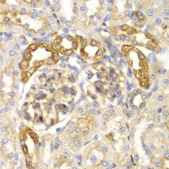 PYCARD / ASC / TMS1 Antibody - Immunohistochemistry of paraffin-embedded rat kidney using PYCARD antibody at dilution of 1:100 (40x lens).
