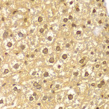 PYCARD / ASC / TMS1 Antibody - Immunohistochemistry of paraffin-embedded mouse liver using PYCARD antibody at dilution of 1:100 (40x lens).