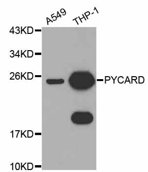 PYCARD / ASC / TMS1 Antibody - Western blot analysis of extracts of various cell lines, using PYCARD antibody at 1:1000 dilution. The secondary antibody used was an HRP Goat Anti-Rabbit IgG (H+L) at 1:10000 dilution. Lysates were loaded 25ug per lane and 3% nonfat dry milk in TBST was used for blocking.