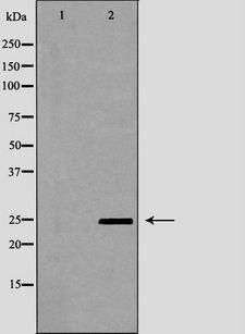 PYCARD / ASC / TMS1 Antibody - Western blot analysis of A549 whole cells lysates using PYCARD antibody. The lane on the left is treated with the antigen-specific peptide.