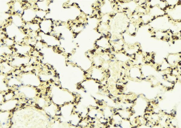 PYCARD / ASC / TMS1 Antibody - 1:100 staining mouse lung tissue by IHC-P. The sample was formaldehyde fixed and a heat mediated antigen retrieval step in citrate buffer was performed. The sample was then blocked and incubated with the antibody for 1.5 hours at 22°C. An HRP conjugated goat anti-rabbit antibody was used as the secondary.