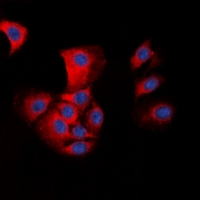 PYCARD / ASC / TMS1 Antibody - Immunofluorescent analysis of ASC staining in HepG2 cells. Formalin-fixed cells were permeabilized with 0.1% Triton X-100 in TBS for 5-10 minutes and blocked with 3% BSA-PBS for 30 minutes at room temperature. Cells were probed with the primary antibody in 3% BSA-PBS and incubated overnight at 4 deg C in a humidified chamber. Cells were washed with PBST and incubated with a DyLight 594-conjugated secondary antibody (red) in PBS at room temperature in the dark. DAPI was used to stain the cell nuclei (blue).