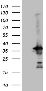 PYCR1 Antibody - HEK293T cells were transfected with the pCMV6-ENTRY control. (Left lane) or pCMV6-ENTRY PYCR1. (Right lane) cDNA for 48 hrs and lysed. Equivalent amounts of cell lysates. (5 ug per lane) were separated by SDS-PAGE and immunoblotted with anti-PYCR1. (1:2000)