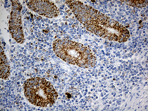 PYCR1 Antibody - Immunohistochemical staining of paraffin-embedded Human appendix tissue within the normal limits using anti-PYCR1 mouse monoclonal antibody. (Heat-induced epitope retrieval by 1mM EDTA in 10mM Tris buffer. (pH8.5) at 120°C for 3 min. (1:500)