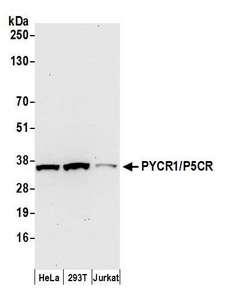 PYCR1 Antibody - Detection of human PYCR1/P5CR by western blot. Samples: Whole cell lysate (50 µg) from HeLa, HEK293T, and Jurkat cells prepared using NETN lysis buffer. Antibody: Affinity purified rabbit anti-PYCR1/P5CR antibody used for WB at 0.1 µg/ml. Detection: Chemiluminescence with an exposure time of 30 seconds.