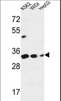 PYCR1 Antibody - PYCR1 Antibody western blot of K562,WiDr,HepG2 cell line lysates (35 ug/lane). The PYCR1 antibody detected the PYCR1 protein (arrow).