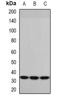 PYCR1 Antibody - Western blot analysis of P5CR expression in HepG2 (A); mouse skeletal muscle (B); rat brain (C) whole cell lysates.