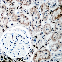 PYCR1 Antibody - Immunohistochemical analysis of P5CR staining in rat kidney formalin fixed paraffin embedded tissue section. The section was pre-treated using heat mediated antigen retrieval with sodium citrate buffer (pH 6.0). The section was then incubated with the antibody at room temperature and detected using an HRP conjugated compact polymer system. DAB was used as the chromogen. The section was then counterstained with hematoxylin and mounted with DPX.
