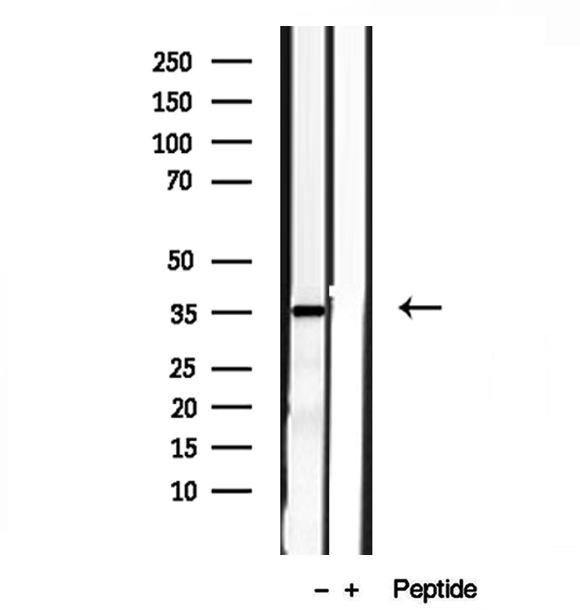 PYCR1 Antibody - Western blot analysis of extracts of HT-1080 cells using PYCR1 antibody.