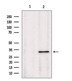 PYCR1 Antibody - Western blot analysis of extracts of mouse Myeloma cells using PYCR1 antibody. Lane 1 was treated with the blocking peptide.
