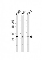 PYCRL Antibody - All lanes : Anti-PYCRL Antibody at 1:2000 dilution Lane 1: A549 whole cell lysates Lane 2: HeLa whole cell lysates Lane 3: KG-1 whole cell lysates Lysates/proteins at 20 ug per lane. Secondary Goat Anti-Rabbit IgG, (H+L), Peroxidase conjugated at 1/10000 dilution Predicted band size : 29 kDa Blocking/Dilution buffer: 5% NFDM/TBST.
