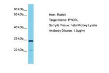 PYCRL Antibody -  This image was taken for the unconjugated form of this product. Other forms have not been tested.