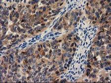 PYCRL Antibody - IHC of paraffin-embedded Human pancreas tissue using anti-PYCRL mouse monoclonal antibody.