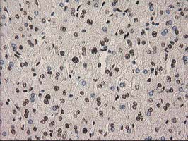PYCRL Antibody - IHC of paraffin-embedded Human liver tissue using anti-PYCRL mouse monoclonal antibody.