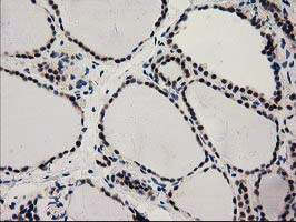 PYCRL Antibody - IHC of paraffin-embedded Human thyroid tissue using anti-PYCRL mouse monoclonal antibody.