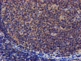 PYCRL Antibody - IHC of paraffin-embedded Human tonsil using anti-PYCRL mouse monoclonal antibody.
