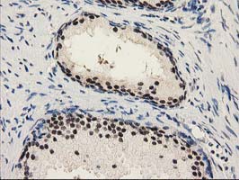 PYCRL Antibody - IHC of paraffin-embedded Human prostate tissue using anti-PYCRL mouse monoclonal antibody.