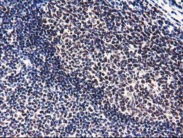 PYCRL Antibody - IHC of paraffin-embedded Human lymph node tissue using anti-PYCRL mouse monoclonal antibody.