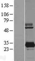 PYCRL Protein - Western validation with an anti-DDK antibody * L: Control HEK293 lysate R: Over-expression lysate