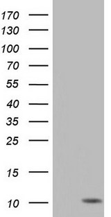 PYDC1 Antibody - HEK293T cells were transfected with the pCMV6-ENTRY control (Left lane) or pCMV6-ENTRY PYDC1 (Right lane) cDNA for 48 hrs and lysed. Equivalent amounts of cell lysates (5 ug per lane) were separated by SDS-PAGE and immunoblotted with anti-PYDC1.