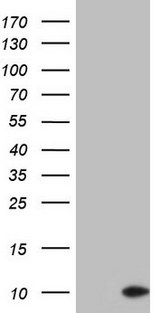 PYDC1 Antibody - HEK293T cells were transfected with the pCMV6-ENTRY control (Left lane) or pCMV6-ENTRY PYDC1 (Right lane) cDNA for 48 hrs and lysed. Equivalent amounts of cell lysates (5 ug per lane) were separated by SDS-PAGE and immunoblotted with anti-PYDC1.