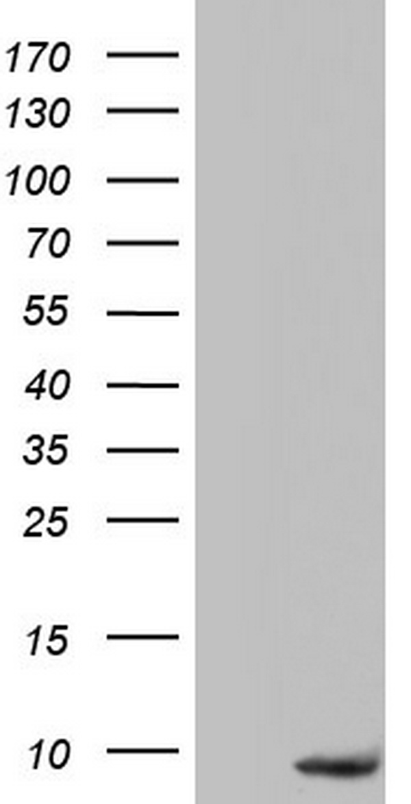 PYDC1 Antibody - HEK293T cells were transfected with the pCMV6-ENTRY control (Left lane) or pCMV6-ENTRY PYDC1 (Right lane) cDNA for 48 hrs and lysed. Equivalent amounts of cell lysates (5 ug per lane) were separated by SDS-PAGE and immunoblotted with anti-PYDC1.