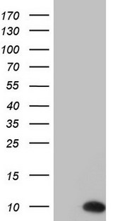 PYDC1 Antibody - HEK293T cells were transfected with the pCMV6-ENTRY control (Left lane) or pCMV6-ENTRY PYDC1 (Right lane) cDNA for 48 hrs and lysed. Equivalent amounts of cell lysates (5 ug per lane) were separated by SDS-PAGE and immunoblotted with anti-PYDC1.
