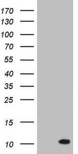 PYDC1 Antibody - HEK293T cells were transfected with the pCMV6-ENTRY control (Left lane) or pCMV6-ENTRY PYDC1 (Right lane) cDNA for 48 hrs and lysed. Equivalent amounts of cell lysates (5 ug per lane) were separated by SDS-PAGE and immunoblotted with anti-PYDC1.