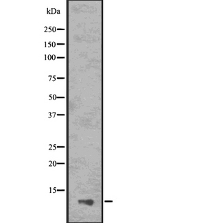 PYDC1 Antibody - Western blot analysis of ASC2 using HepG2 whole cells lysates