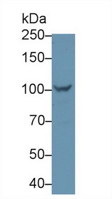 PYGL Antibody - Western Blot; Sample: Rat Liver lysate; Primary Ab: 1µg/ml Rabbit Anti-Rat PYGL Antibody Second Ab: 0.2µg/mL HRP-Linked Caprine Anti-Rabbit IgG Polyclonal Antibody (Catalog: SAA544Rb19