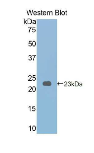 PYGL Antibody - Western blot of recombinant PYGL.  This image was taken for the unconjugated form of this product. Other forms have not been tested.