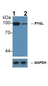 PYGL Antibody - Knockout Varification: Lane 1: Wild-type Hepg2 cell lysate; Lane 2: PYGL knockout Hepg2 cell lysate; Predicted MW: 97kDa ; Observed MW: 100kDa; Primary Ab: 1µg/ml Rabbit Anti-Rat PYGL Ab; Second Ab: 0.2µg/mL HRP-Linked Caprine Anti-Rabbit IgG Polyclonal Antibody;