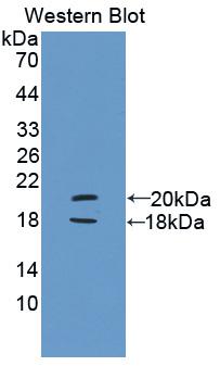 PYGL Antibody - Western Blot; Sample: Recombinant protein.