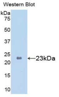 PYGL Antibody - Western blot of recombinant PYGL.  This image was taken for the unconjugated form of this product. Other forms have not been tested.