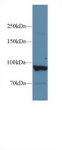 PYGL Antibody - Western Blot; Sample: Human Liver lysate; Primary Ab: 1µg/ml Rabbit Anti-Human PYGL Antibody Second Ab: 0.2µg/mL HRP-Linked Caprine Anti-Rabbit IgG Polyclonal Antibody