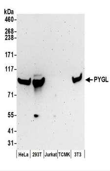 PYGL Antibody - Detection of Human and Mouse PYGL by Western Blot. Samples: Whole cell lysate (50 ug) prepared using NETN buffer from HeLa, 293T, Jurkat, mouse TCMK-1, and mouse NIH3T3 cells. Antibodies: Affinity purified rabbit anti-PYGL antibody used for WB at 0.1 ug/ml. Detection: Chemiluminescence with an exposure time of 3 minutes.