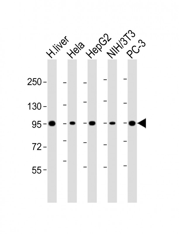 PYGL Antibody - All lanes: Anti-PYGL Antibody (C-Term) at 1:2000 dilution. Lane 1: human liver lysate. Lane 2: HeLa whole cell lysate. Lane 3: HepG2 whole cell lysate. Lane 4: NIH/3T3 whole cell lysate. Lane 5: PC-3 whole cell lysate Lysates/proteins at 20 ug per lane. Secondary Goat Anti-Rabbit IgG, (H+L), Peroxidase conjugated at 1:10000 dilution. Predicted band size: 97 kDa. Blocking/Dilution buffer: 5% NFDM/TBST.