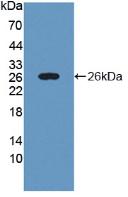 PYGL Antibody - Western Blot ;Sample: Recombinant PYGL, Rat.