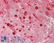 PYGL Antibody - Human Liver: Formalin-Fixed, Paraffin-Embedded (FFPE).  This image was taken for the unconjugated form of this product. Other forms have not been tested.