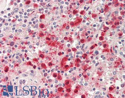 PYGL Antibody - Human Spleen: Formalin-Fixed, Paraffin-Embedded (FFPE).  This image was taken for the unconjugated form of this product. Other forms have not been tested.