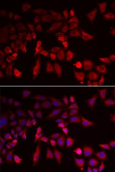 PYGL Antibody - Immunofluorescence analysis of MCF-7 cells.