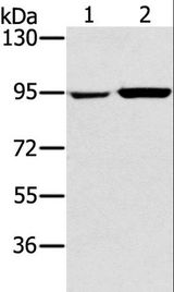 PYGL Antibody - Western blot analysis of 231 and PC3 cell, using PYGL Polyclonal Antibody at dilution of 1:400.