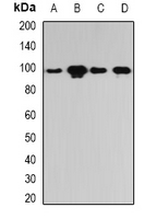 PYGL Antibody - Western blot analysis of PYGL expression in HeLa (A); SKOV3 (B); mouse lung (C); rat liver (D) whole cell lysates.